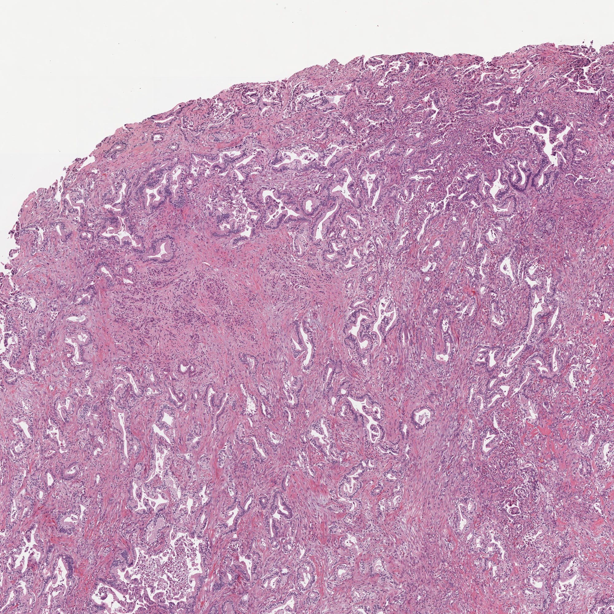 pancreas
